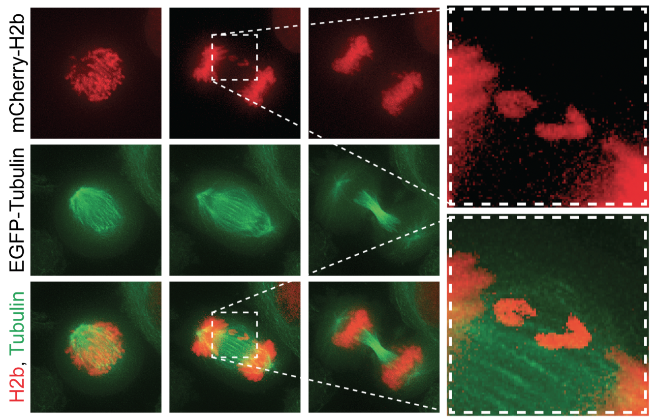 Chromosome mis-segregation in a human cell