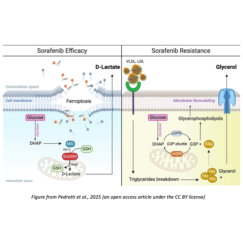 Leveraging cancer cell metabolism to monitor response to sorafenib treatment in liver cancer